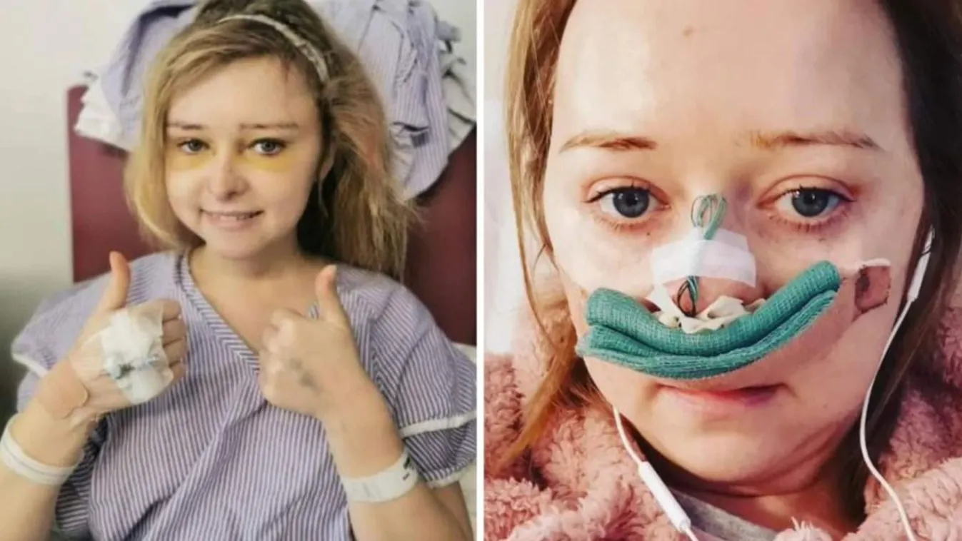 Rutinvizsgálatnak indult, súlyos diagnózist kapott a fiatal