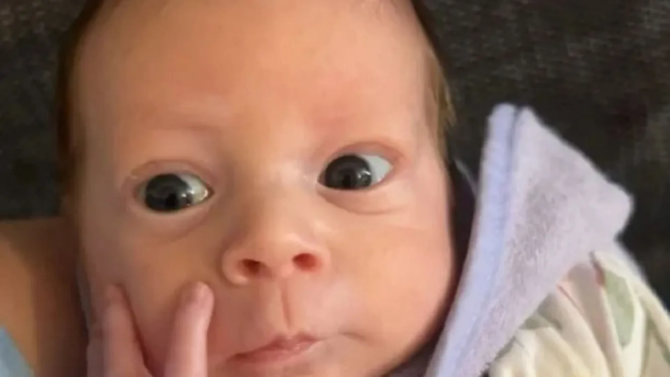 Szerveivel a testén kívül jött világra egy baba, de túlélte