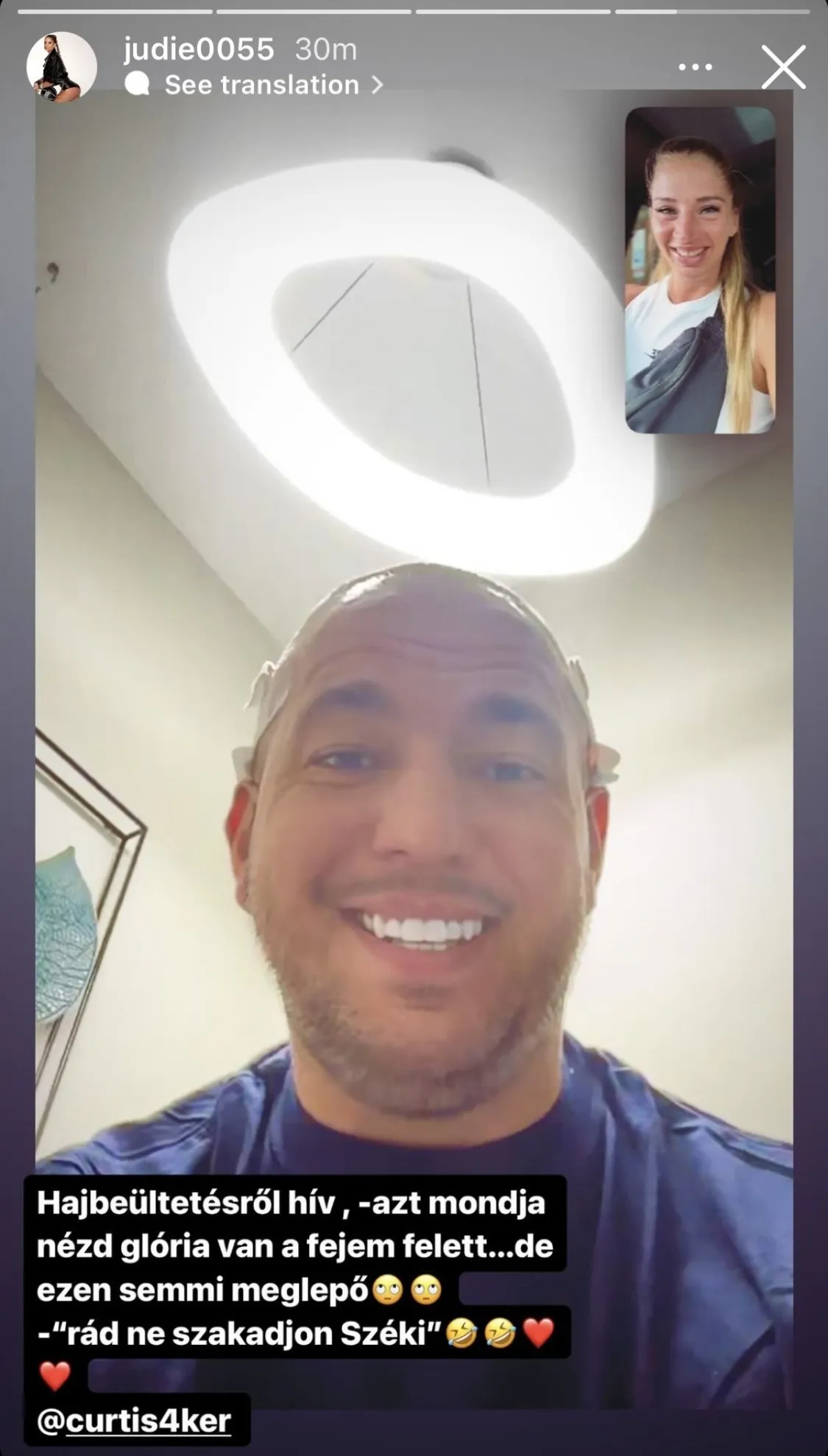 Curtis hajbeültetés