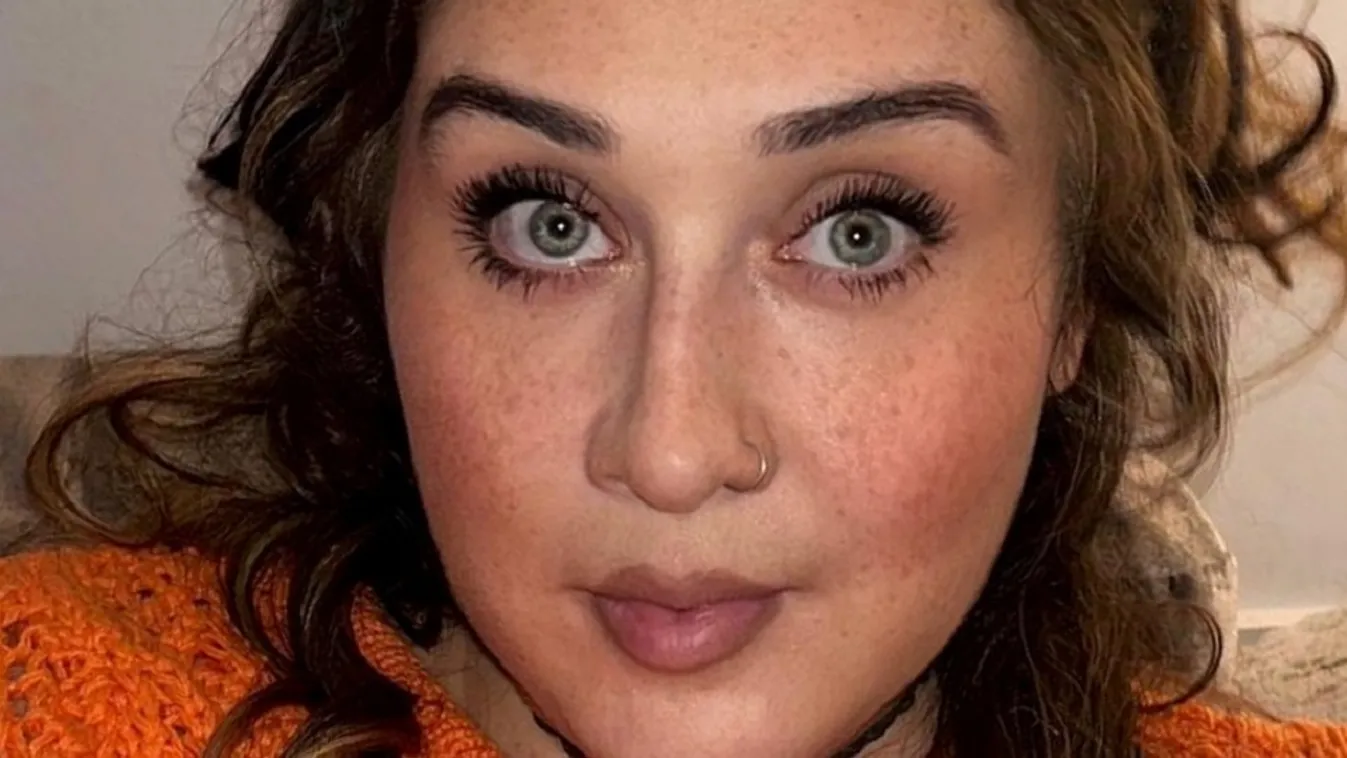 Fémcsővel a torkában kell élnie ritka betegsége miatt