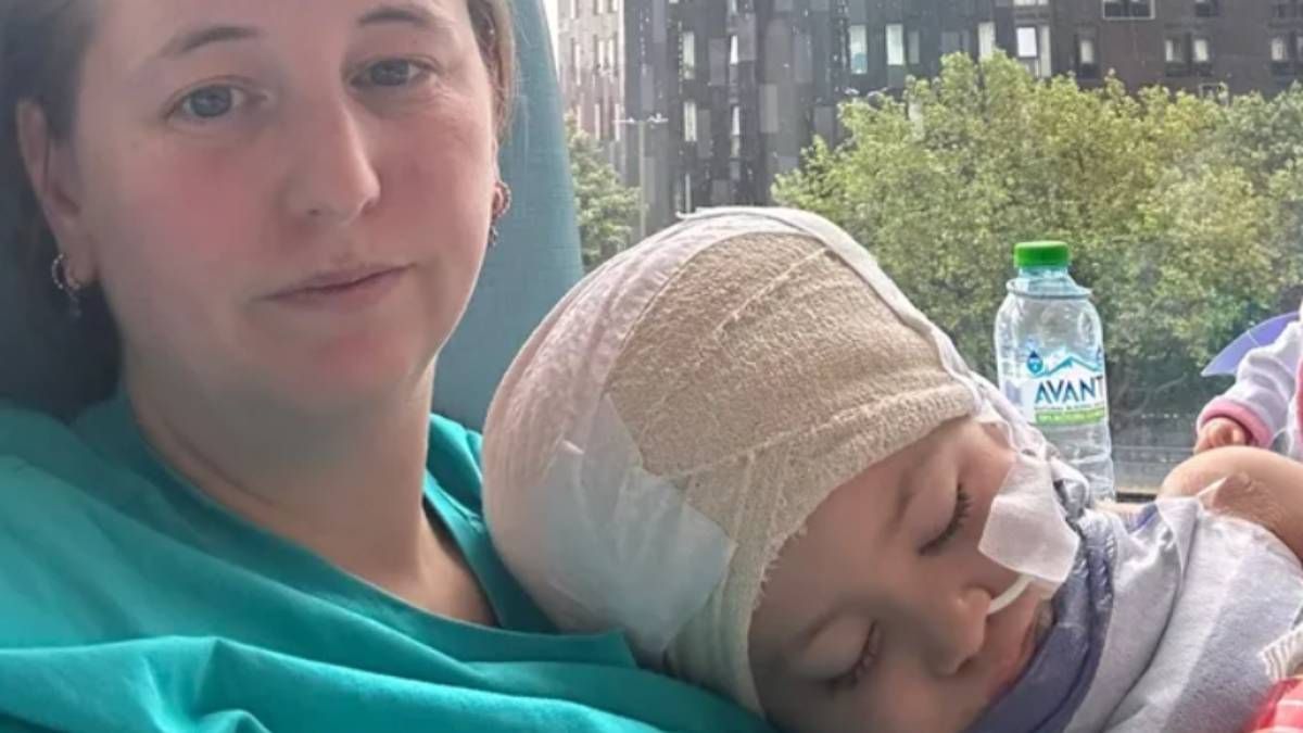 "Szerencsés, hogy túlélte" – szörnyű baleset, lángolt a tündéri négyéves kislány