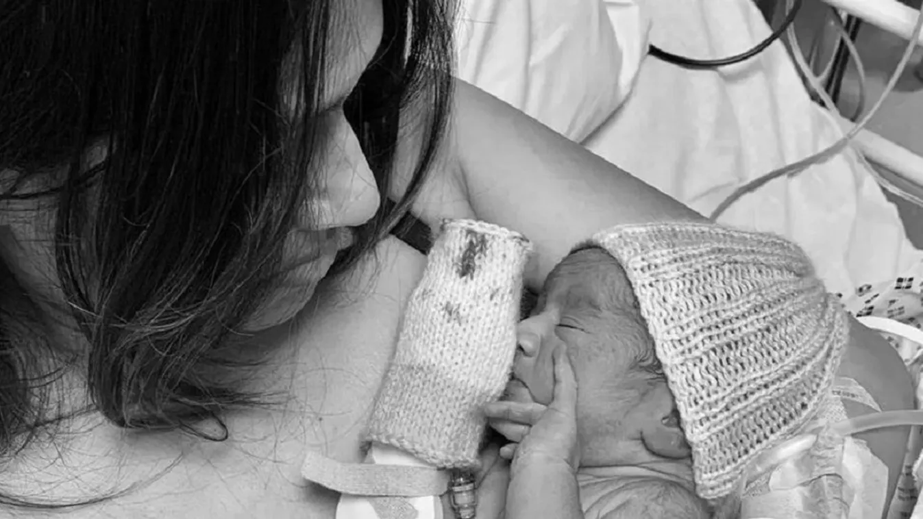 Egyszerre került életveszélybe az anyuka és újszülöttje