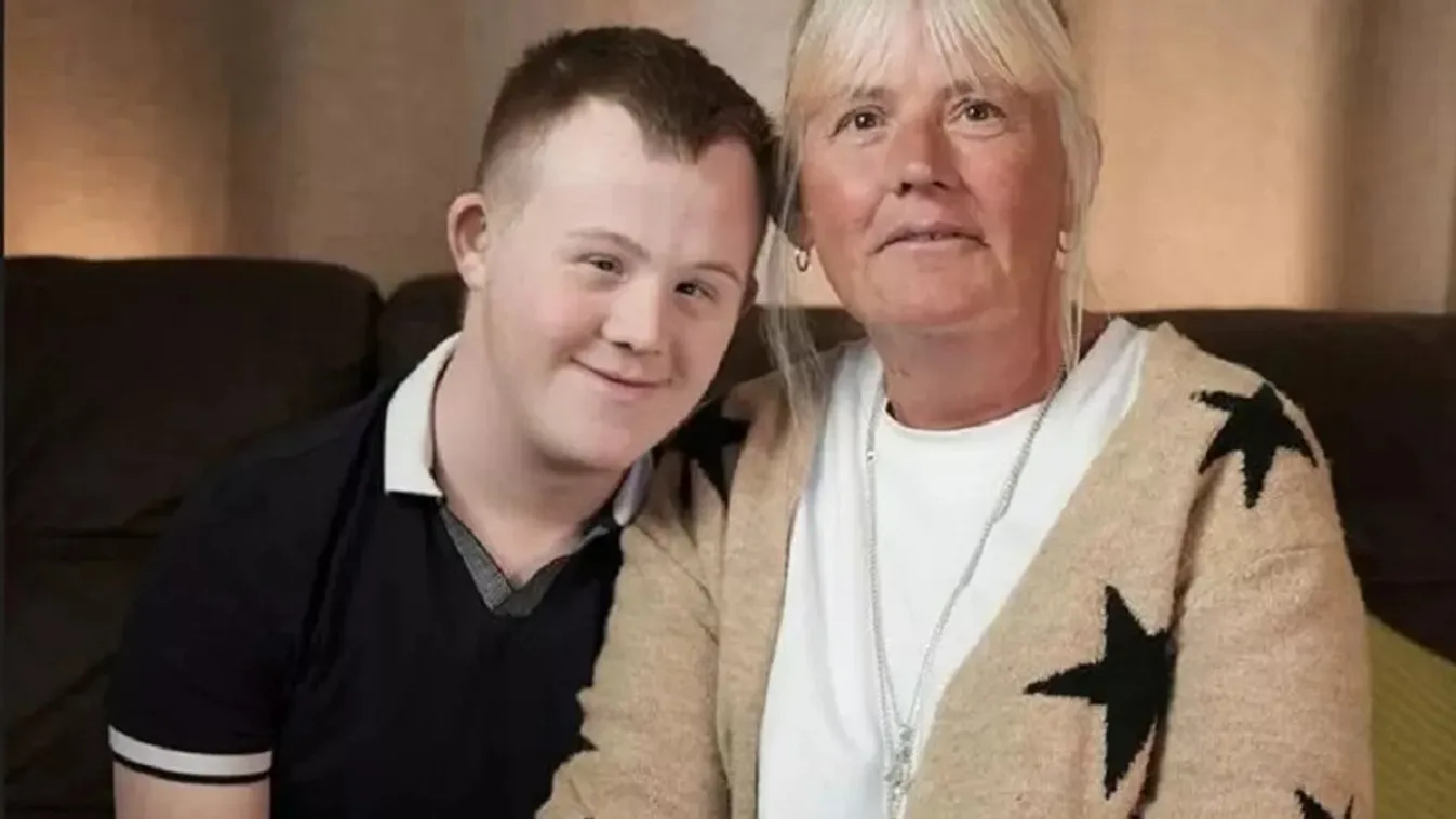 Fájt a hasa, súlyos betegség kínozza a Down-szindrómás tinit