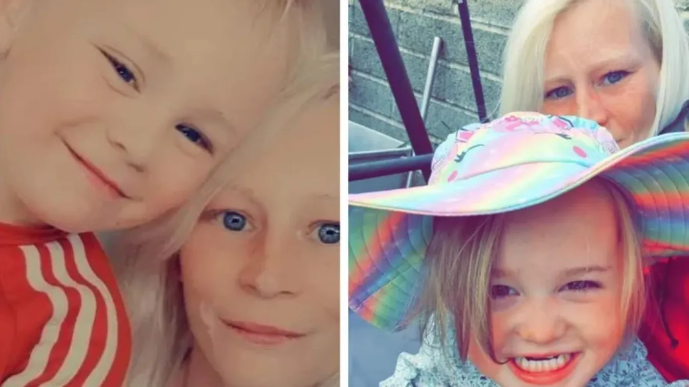 Majdnem éhen halt egy édesanya, miután elrontották a fogorvosi beavatkozást