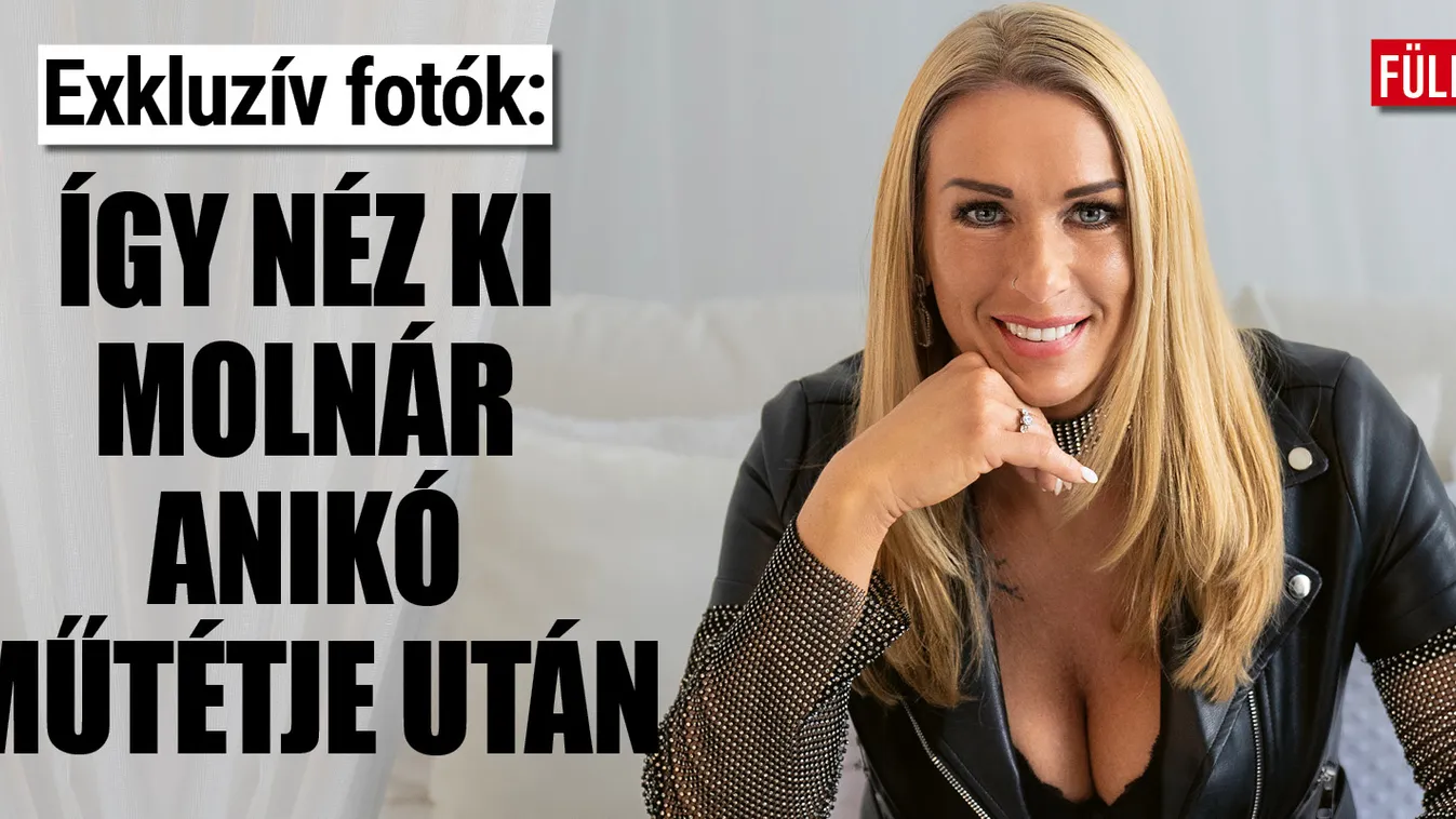Molnár Anikó plasztikázás után megmutatta az új arcát