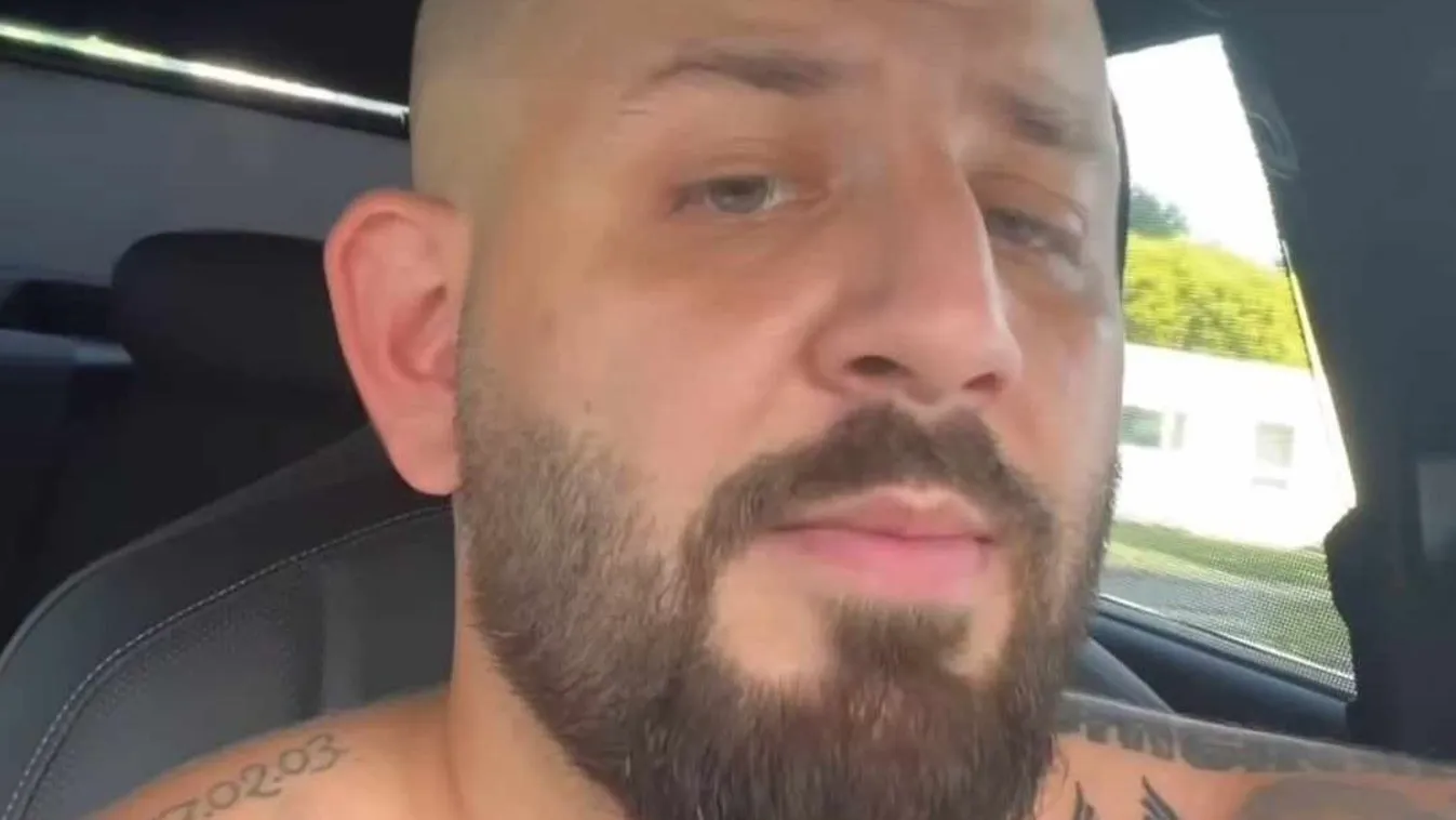 „Én kórházban voltam” - G.w.M félmeztelenül méltatlankodik