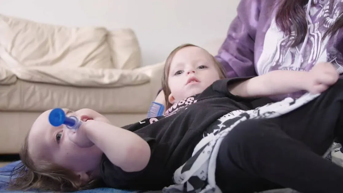 sziámi ikrek, Callie és Carter, YouTube, Truly