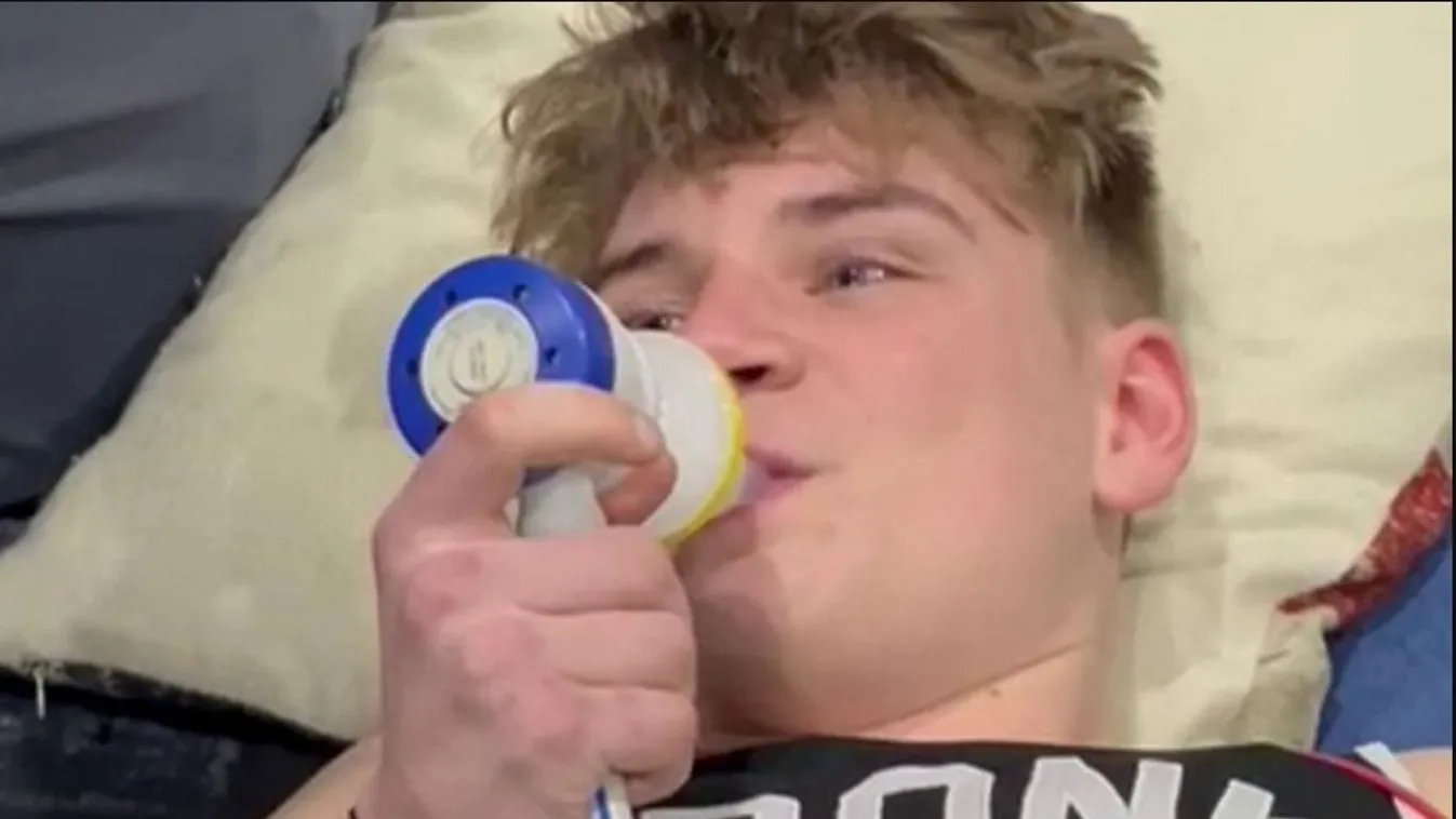 Ritka rák miatt vesztette el az egyik lábát egy 16 éves fiú