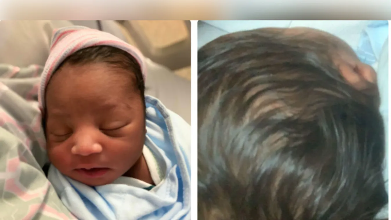 Egészséges fiút szült egy nő, pedig nem tudta, hogy terhes