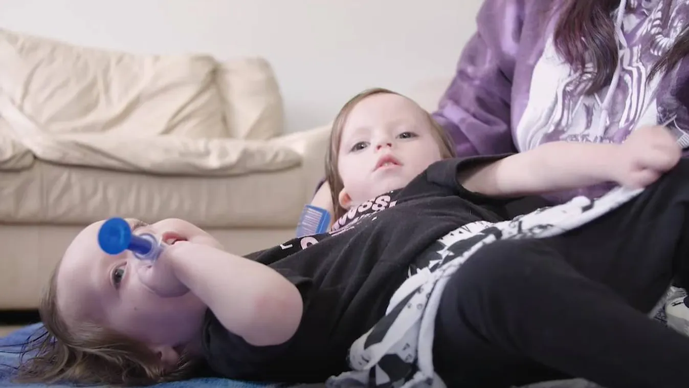 24 órát adtak az orvosok a csodaikreknek: még mindig élnek