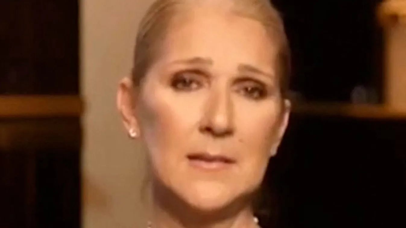 Megmutatta Céline Dion, hogy néz ki egy görcsrohama