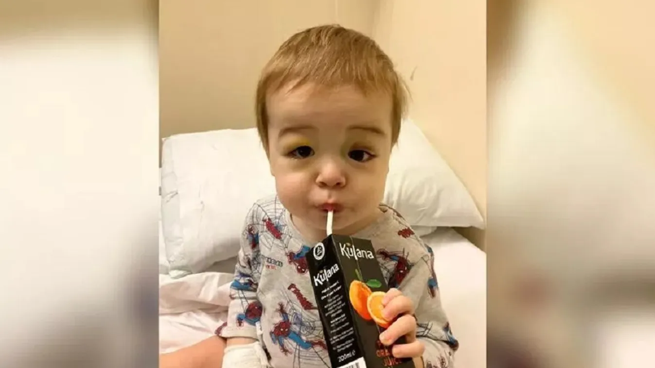 Halált jelzett a 2 éves fekete szeme