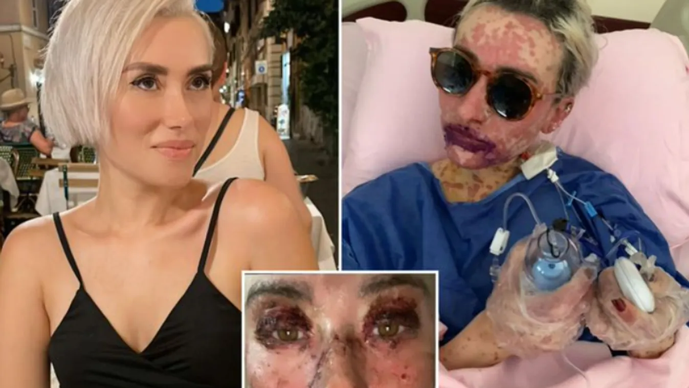 Belülről égett majdnem halálra a nő a gyógyszere miatt