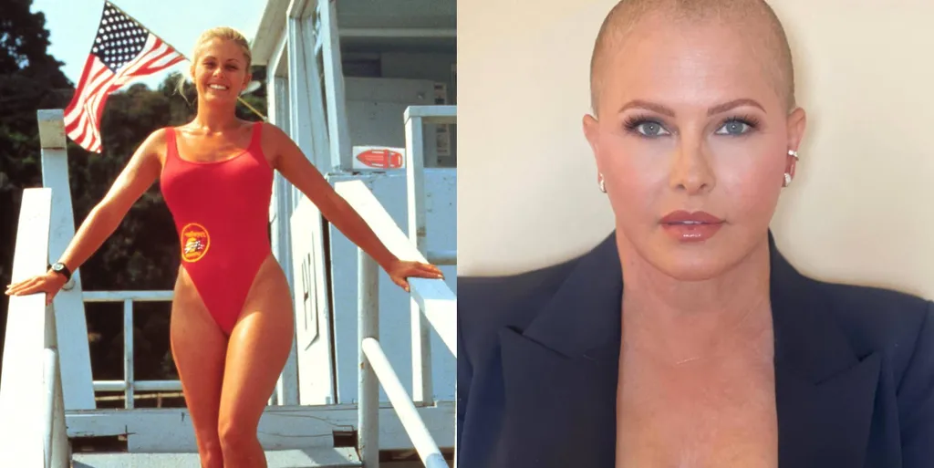 Nicole Eggertre alig lehet ráismerni.  Az 52 éves színésznő rákkal küzd, ezért hullott ki a haja.