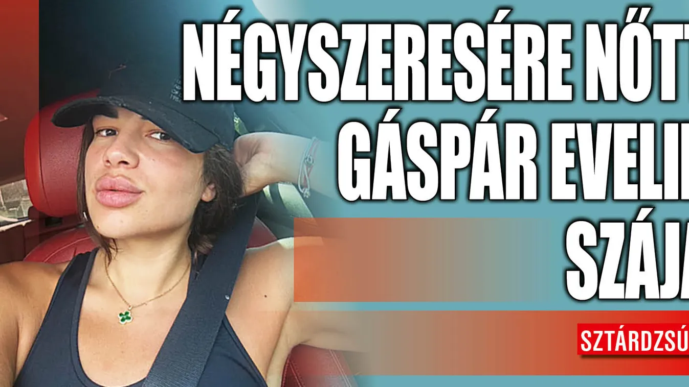Négyszeresére plasztikáztatta a száját Gáspár Evelin - fotó