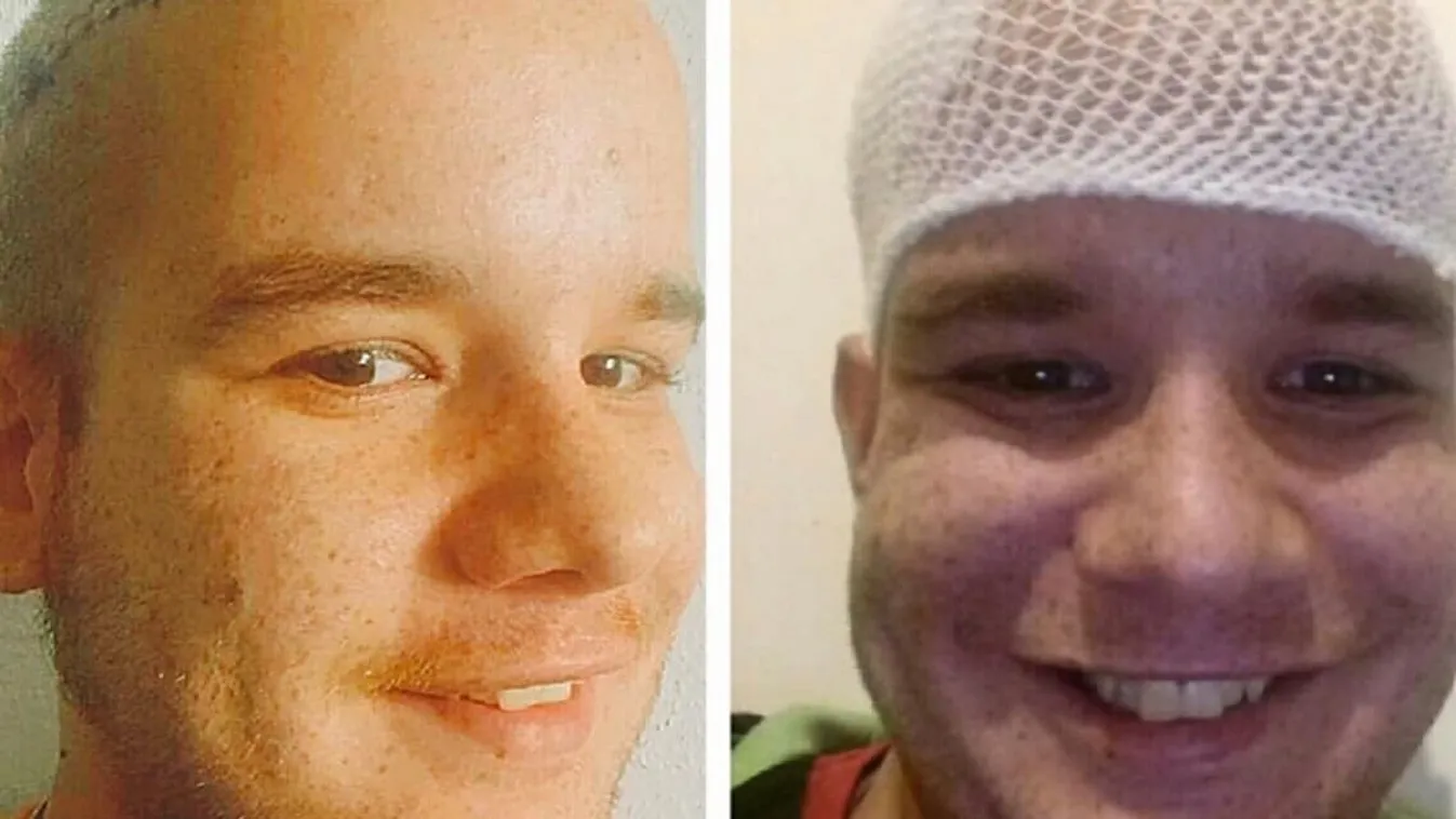 Napszúrás miatt borzasztó fájdalmak kínozzák Dávidot