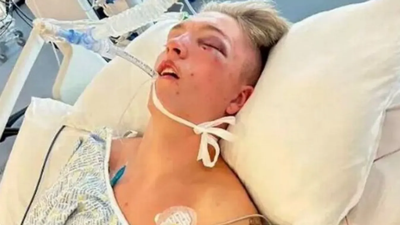 Megcsörrent a szülők telefonja: A fiatok élet-halál közt van