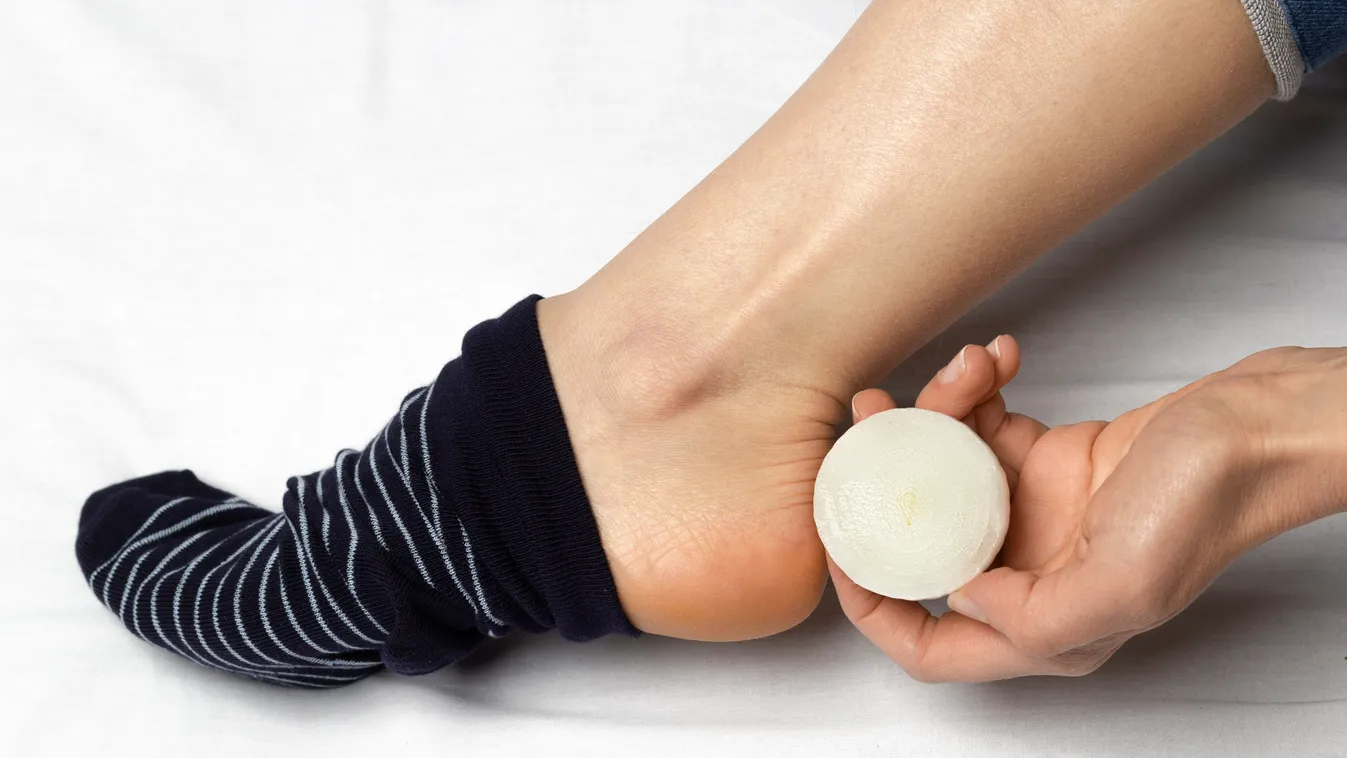 Tegyél hagymát a zoknidba, elképesztő lesz a hatás