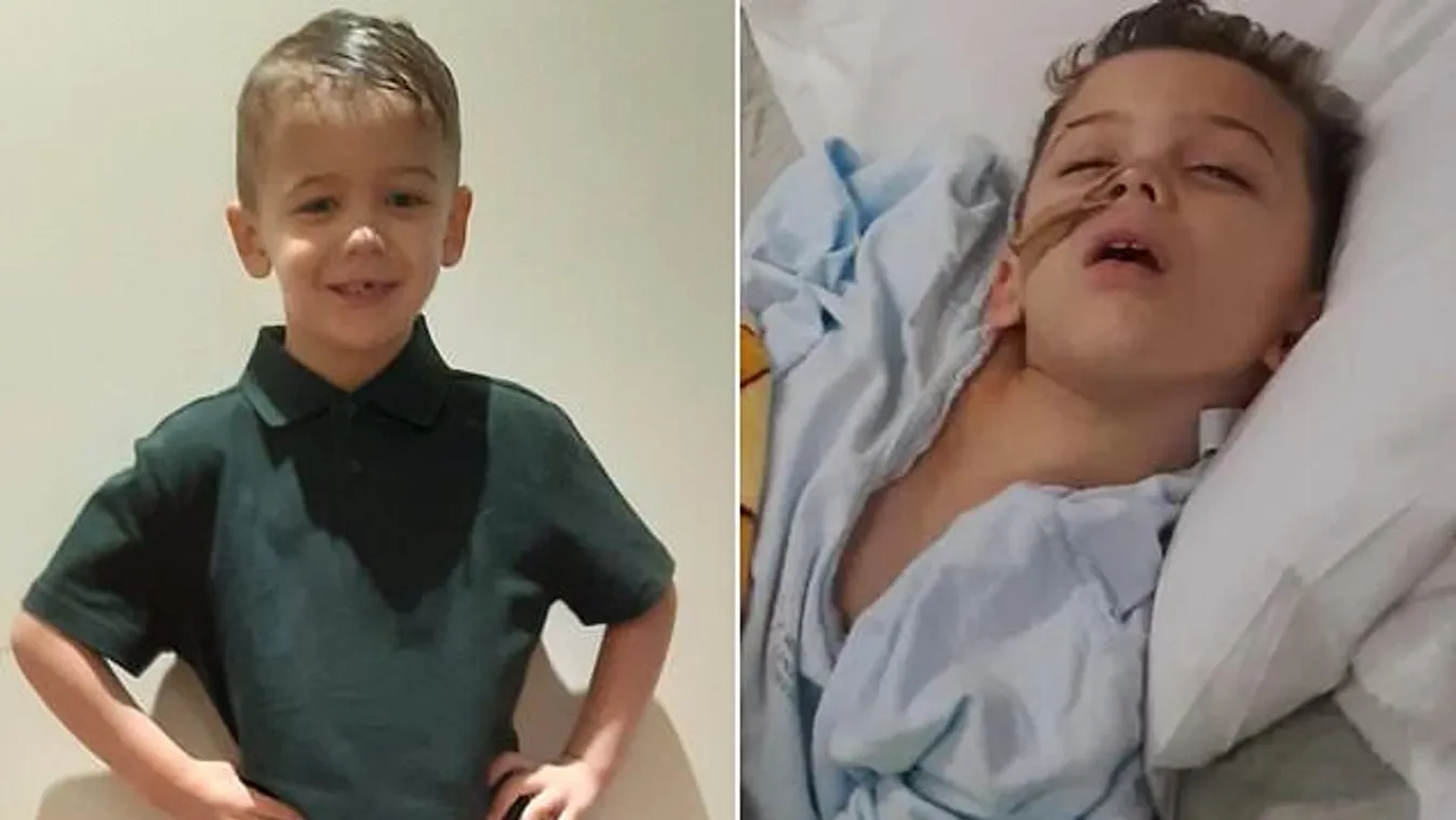 Hétköznapi betegség miatt képtelen beszélni és járni