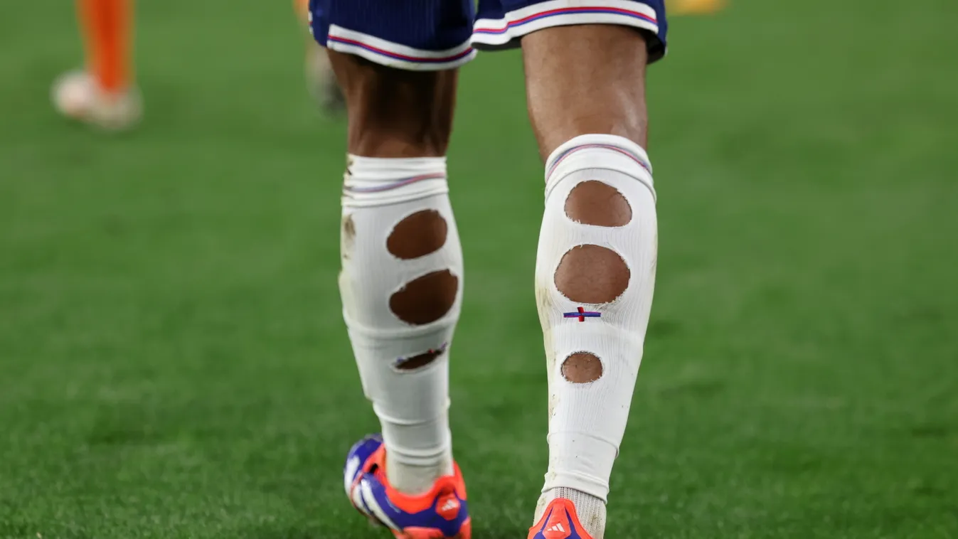 Kiderült, miért vágtak lyukat zoknijukba a focisták az Eb-n