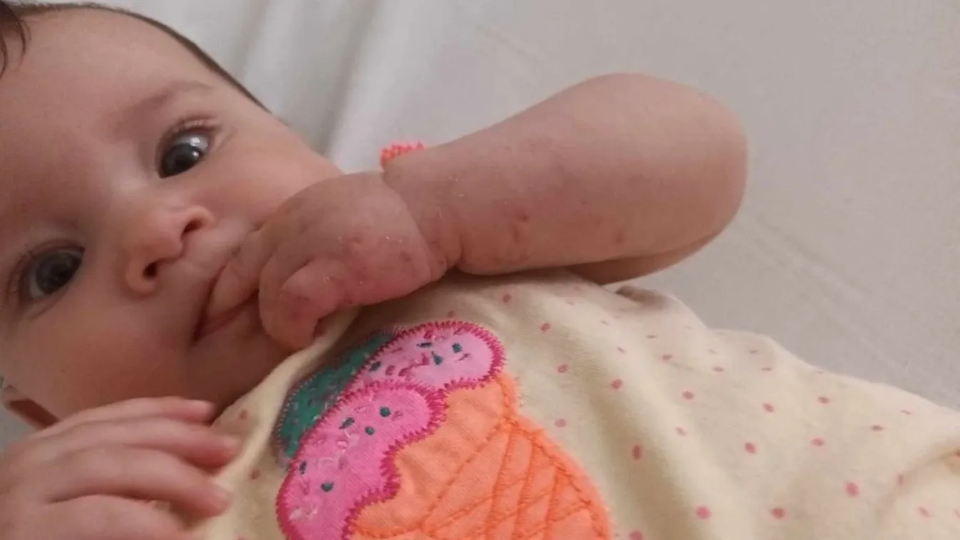 Fordulat a patkány harapta kislány családjának életében