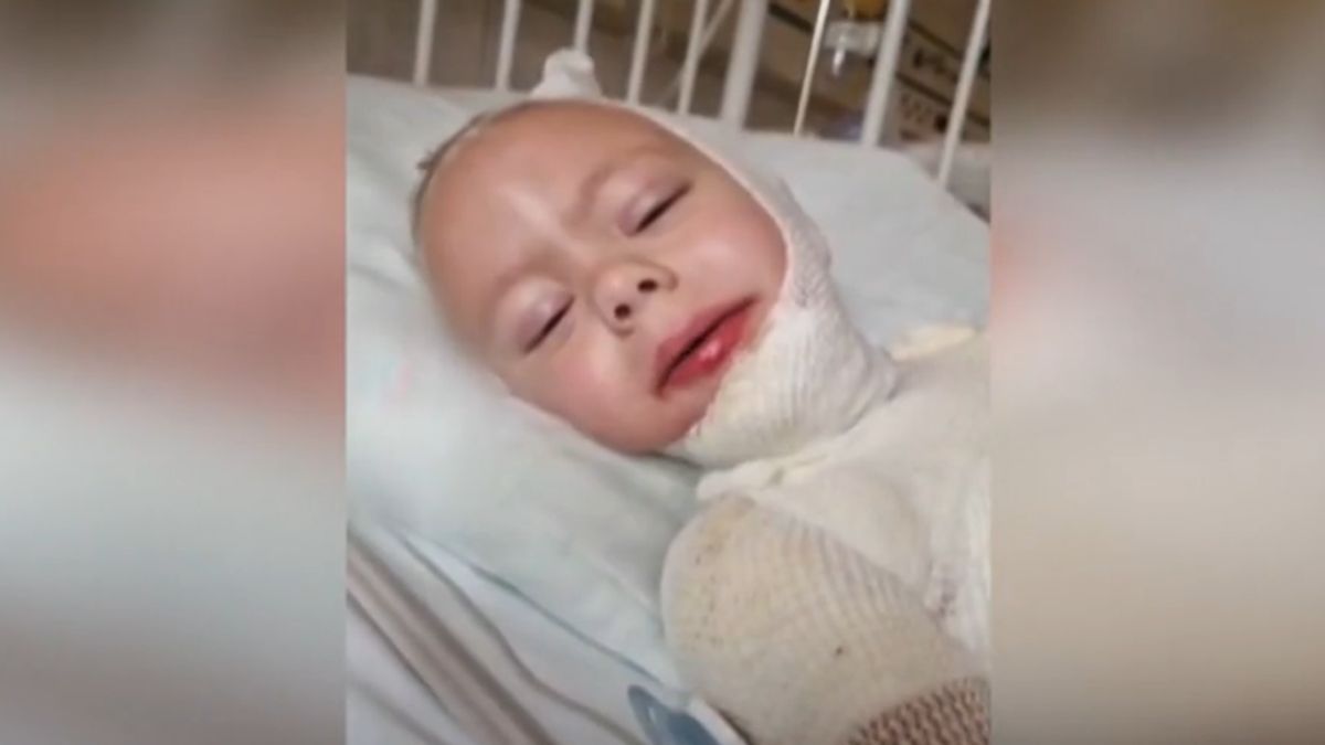Beleégett a bőrébe a ruha: forró olaj égette össze a 4 éves Ricsit, sírva beszéltek a szülők a balesetről - videó