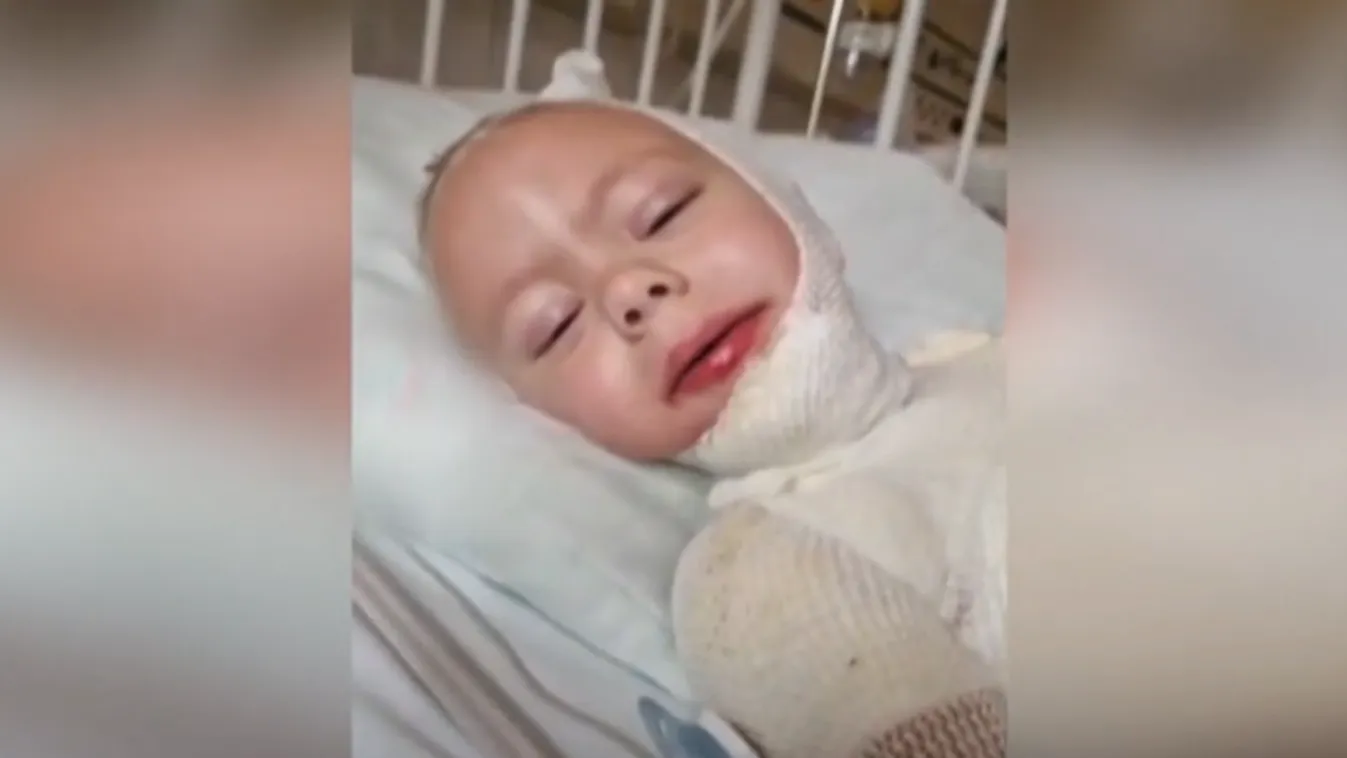 Forró olaj égette össze Ricsit, sírva beszéltek a szülők