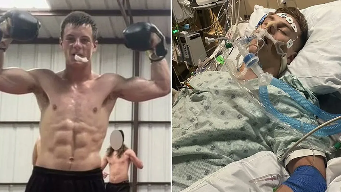 Összecsuklott az edzésen a 18 éves tini, meghalt