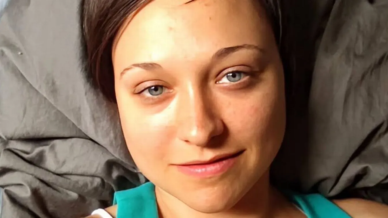 Furcsa kór támadta meg a fiatal nőt