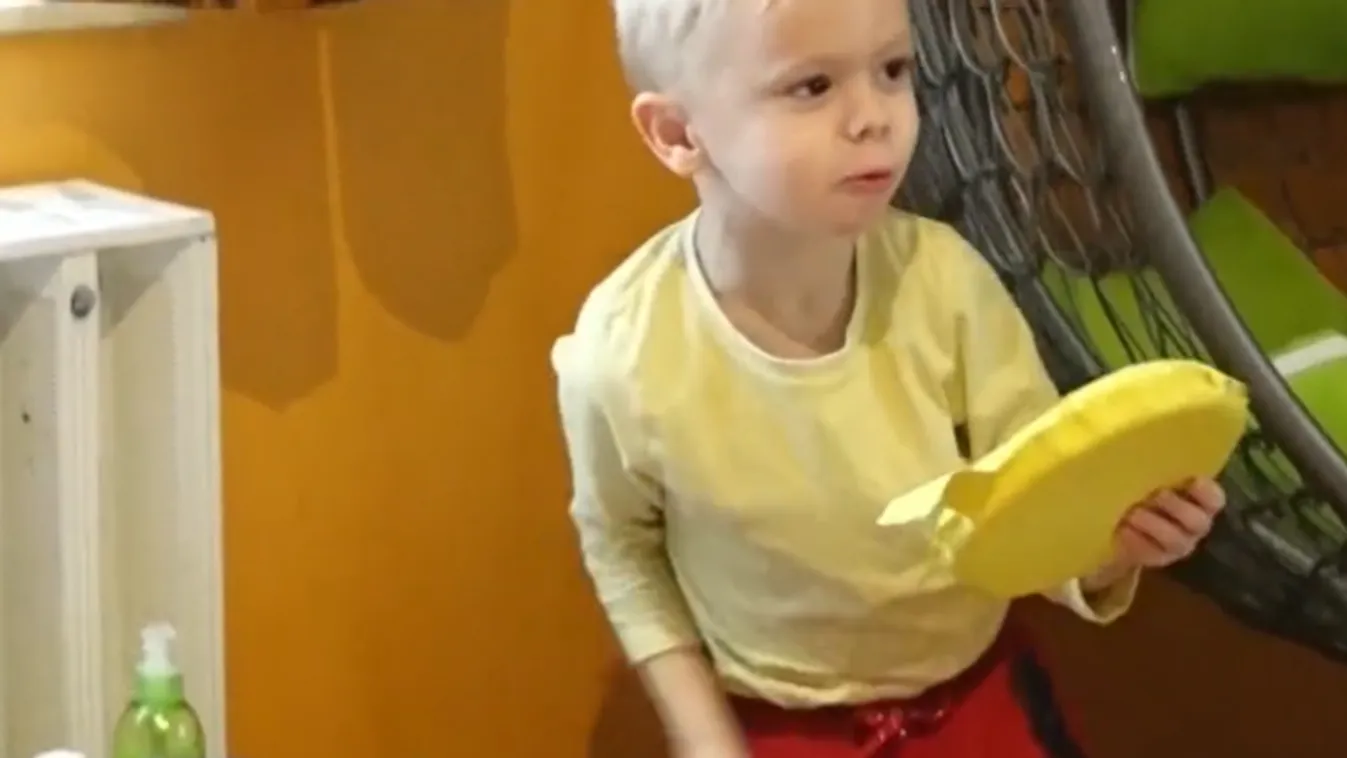 Így van most a hússütés közben összeégett négyéves Ricsi