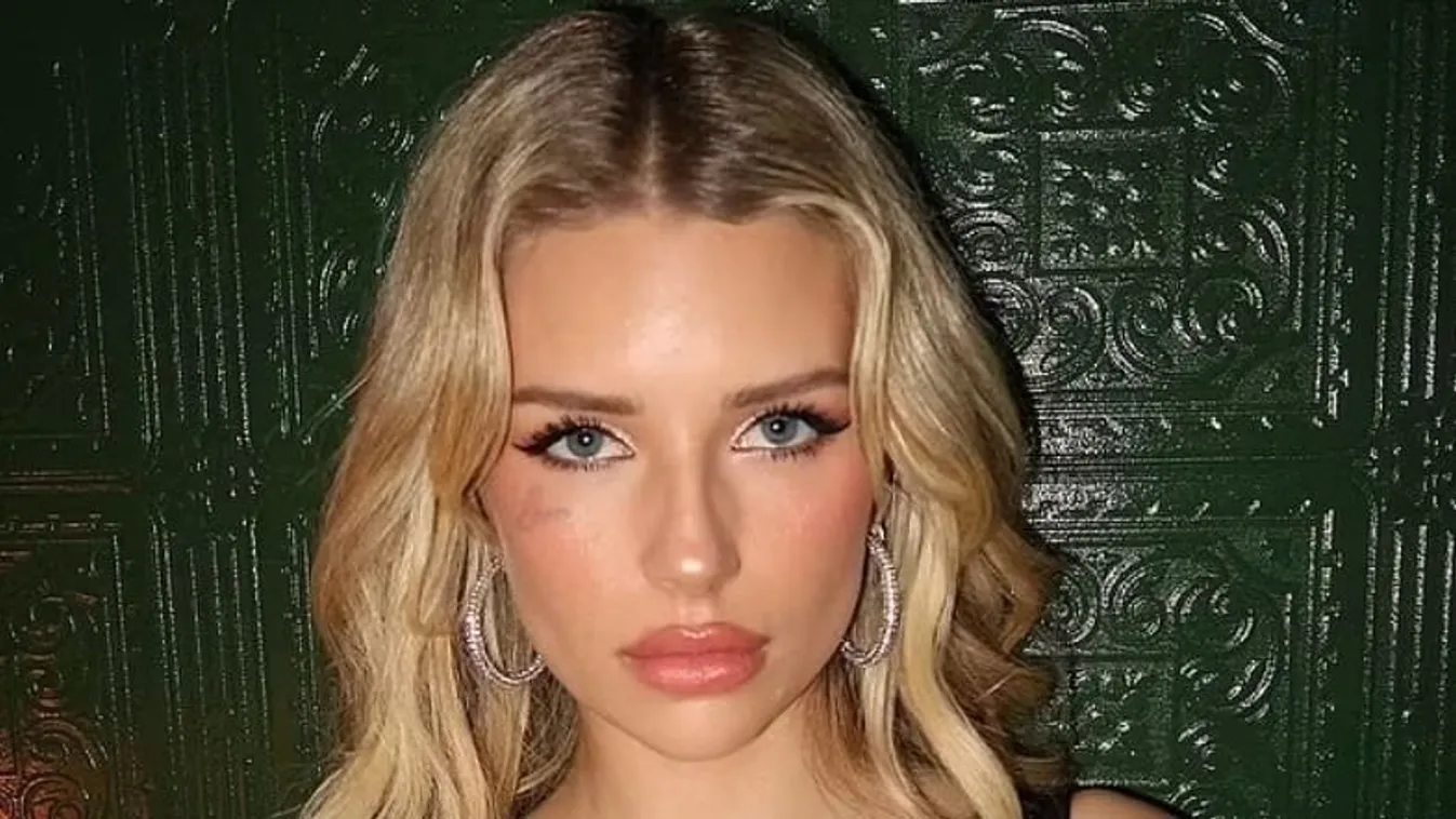 Az Ozempictől életveszélybe került a híres modell