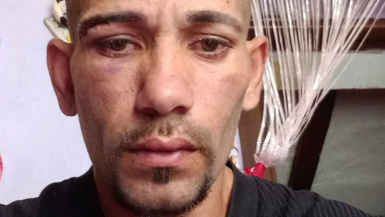 Ököllel vertek össze egy férfit Kunmadarason