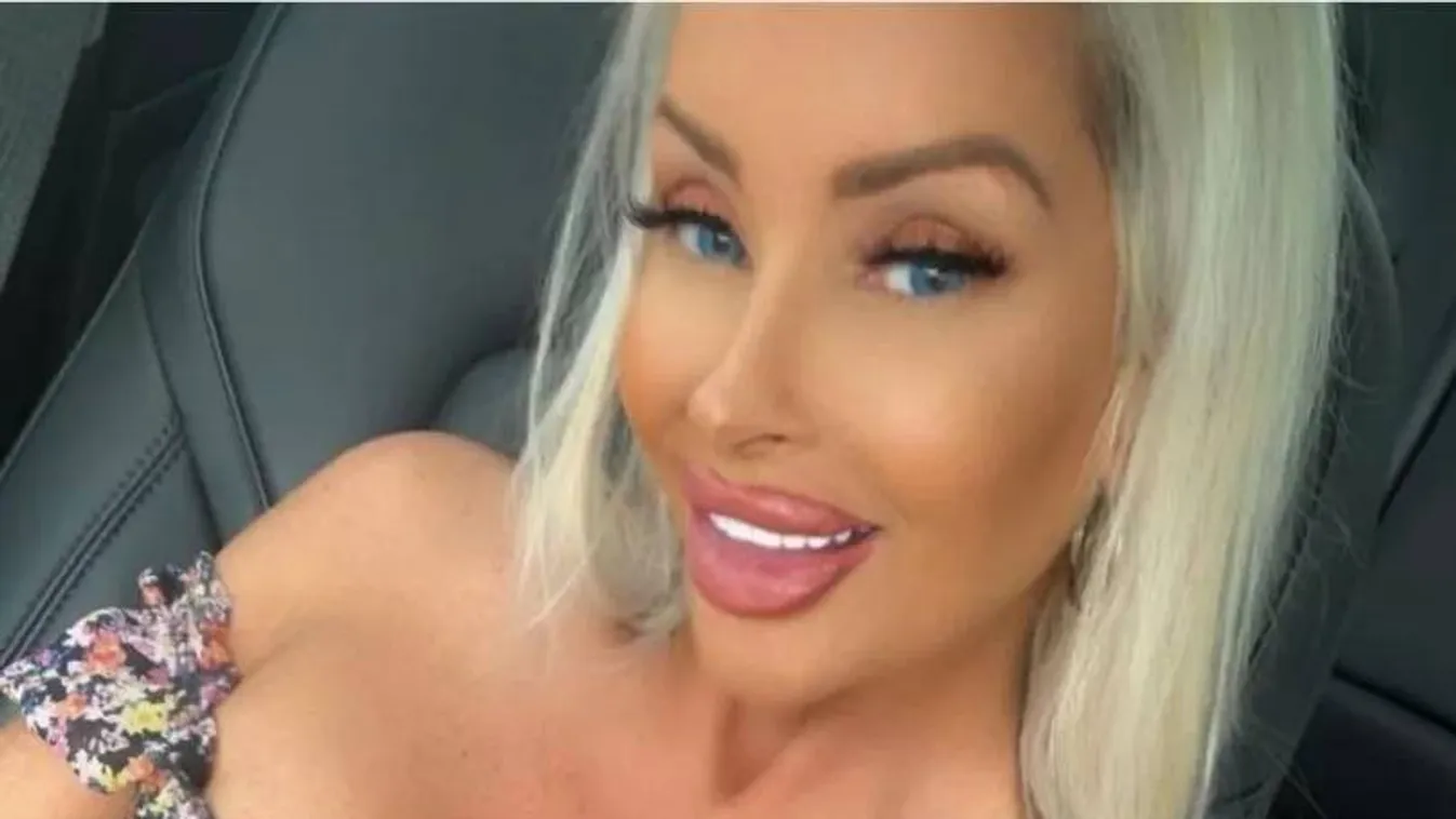 "A gazdag férjemtől való szakítás után teljesen leégtem – még a Botoxot vagy a szájfeltöltést sem engedhetem meg magamnak"