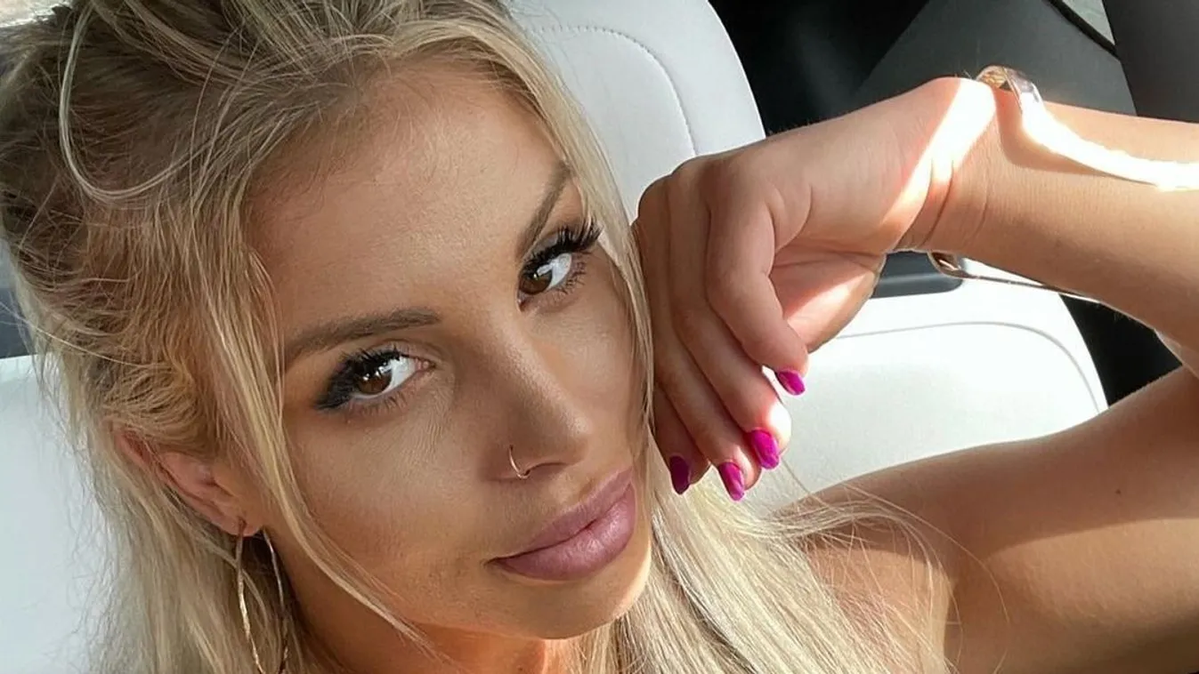 Kiderült, ezért plasztikáztat az Exatlon bombázója