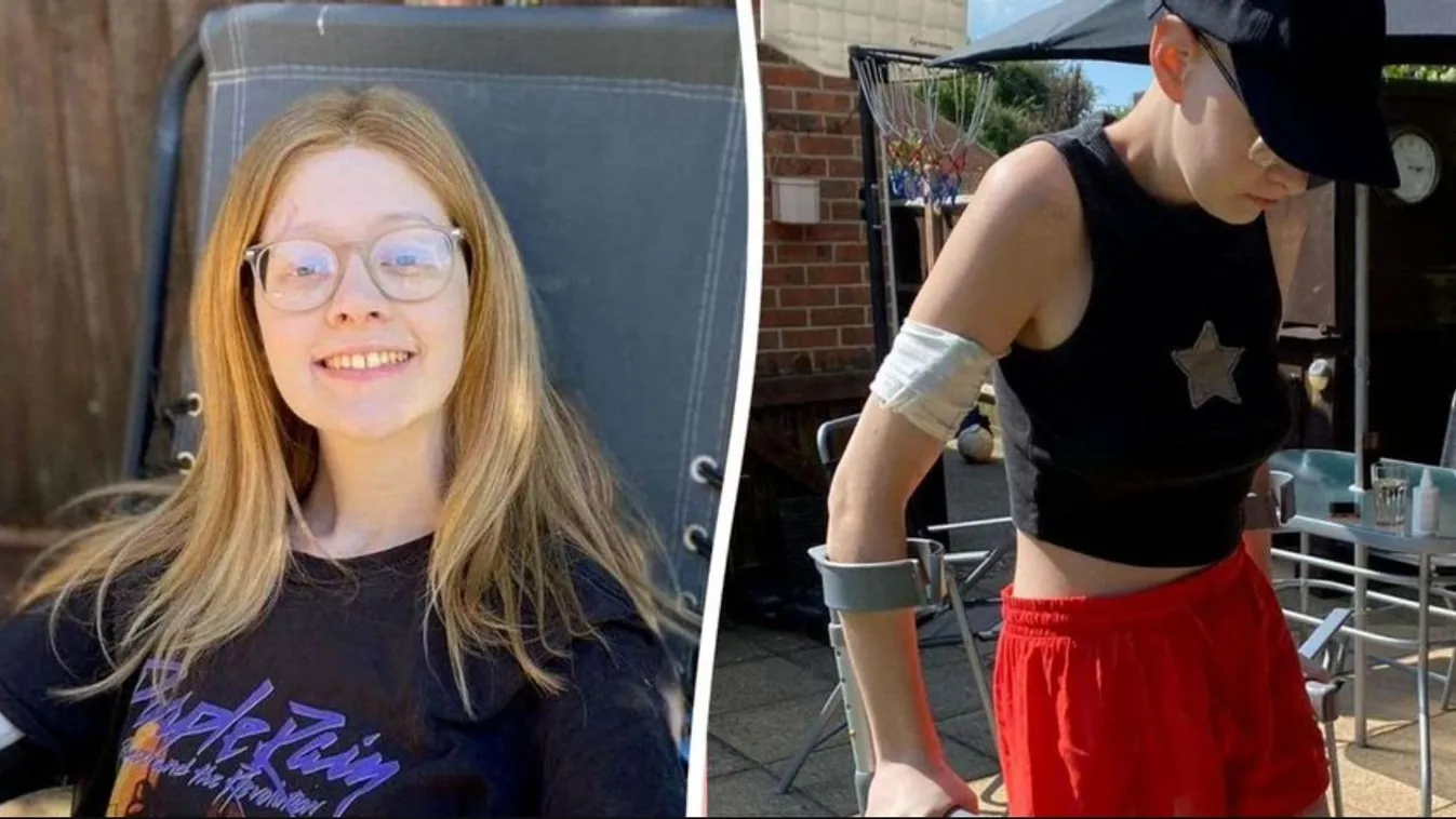 Amputálni kellett a 20 éves lány lábát