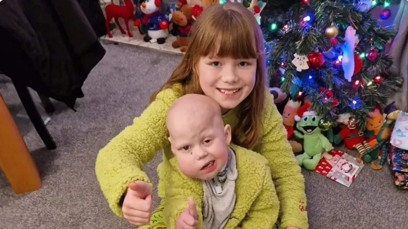 Szülei karjai közt hunyt el a daganattal született kislány