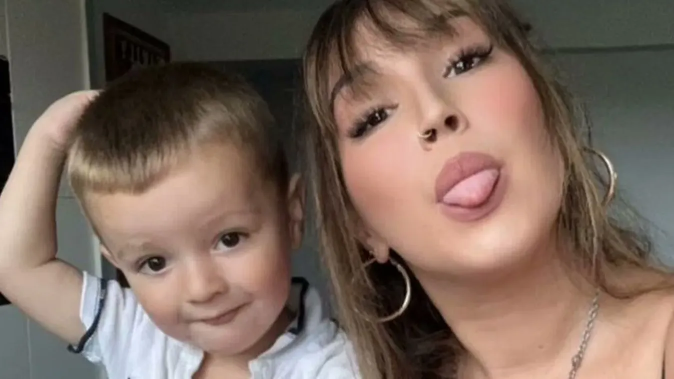 Ritka rendellenességgel született egy kisfiú