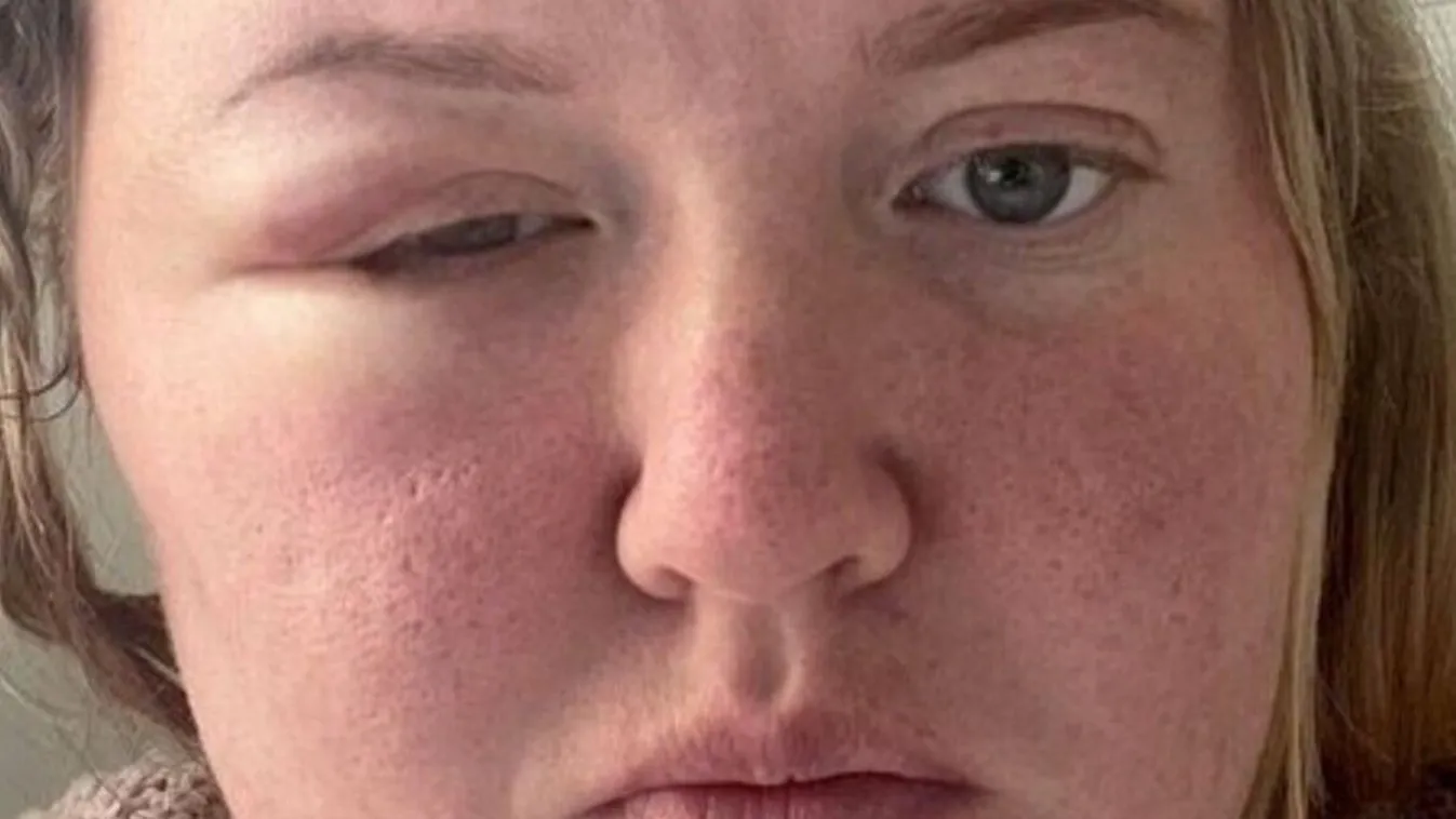 A fejét fájlalta a családanya: most az élete a tét