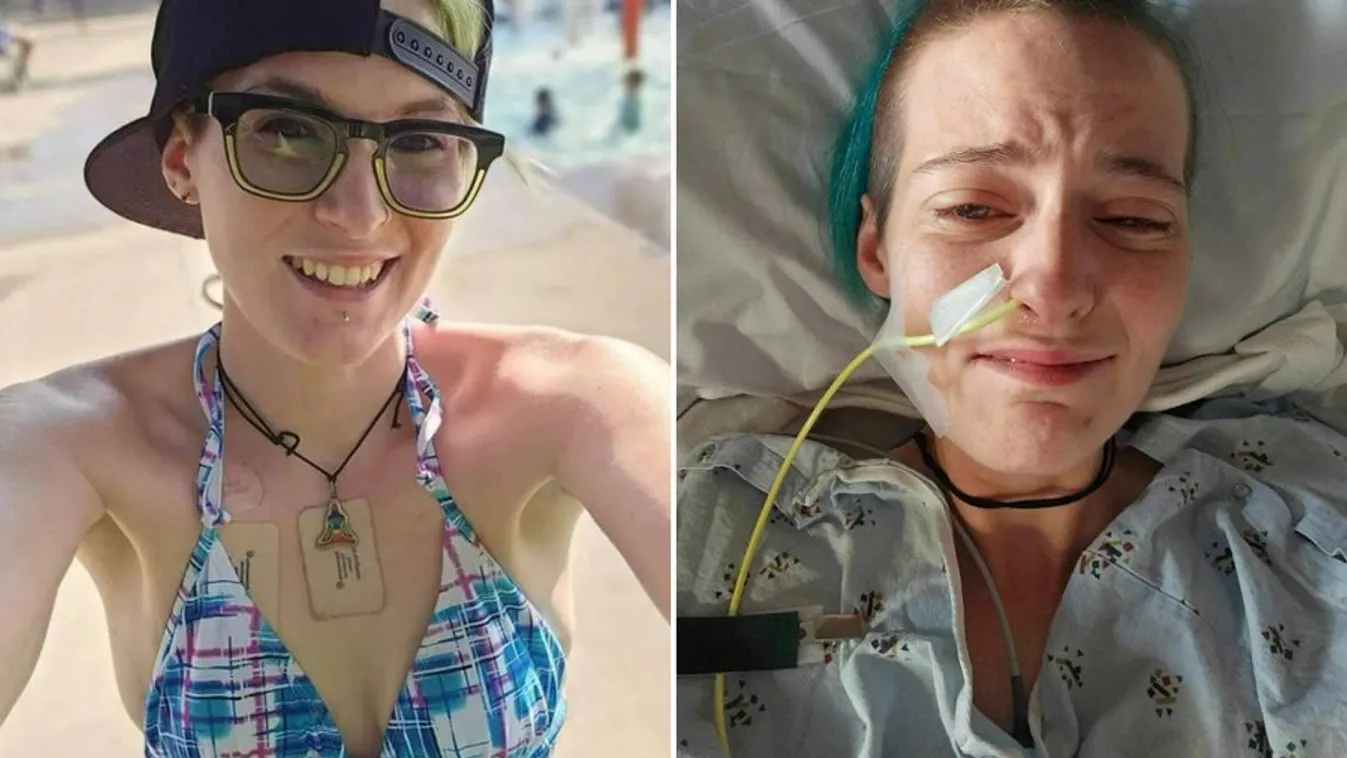  Napi 30-szor hány, egy étkezésbe is belehalhat a 30 éves nő