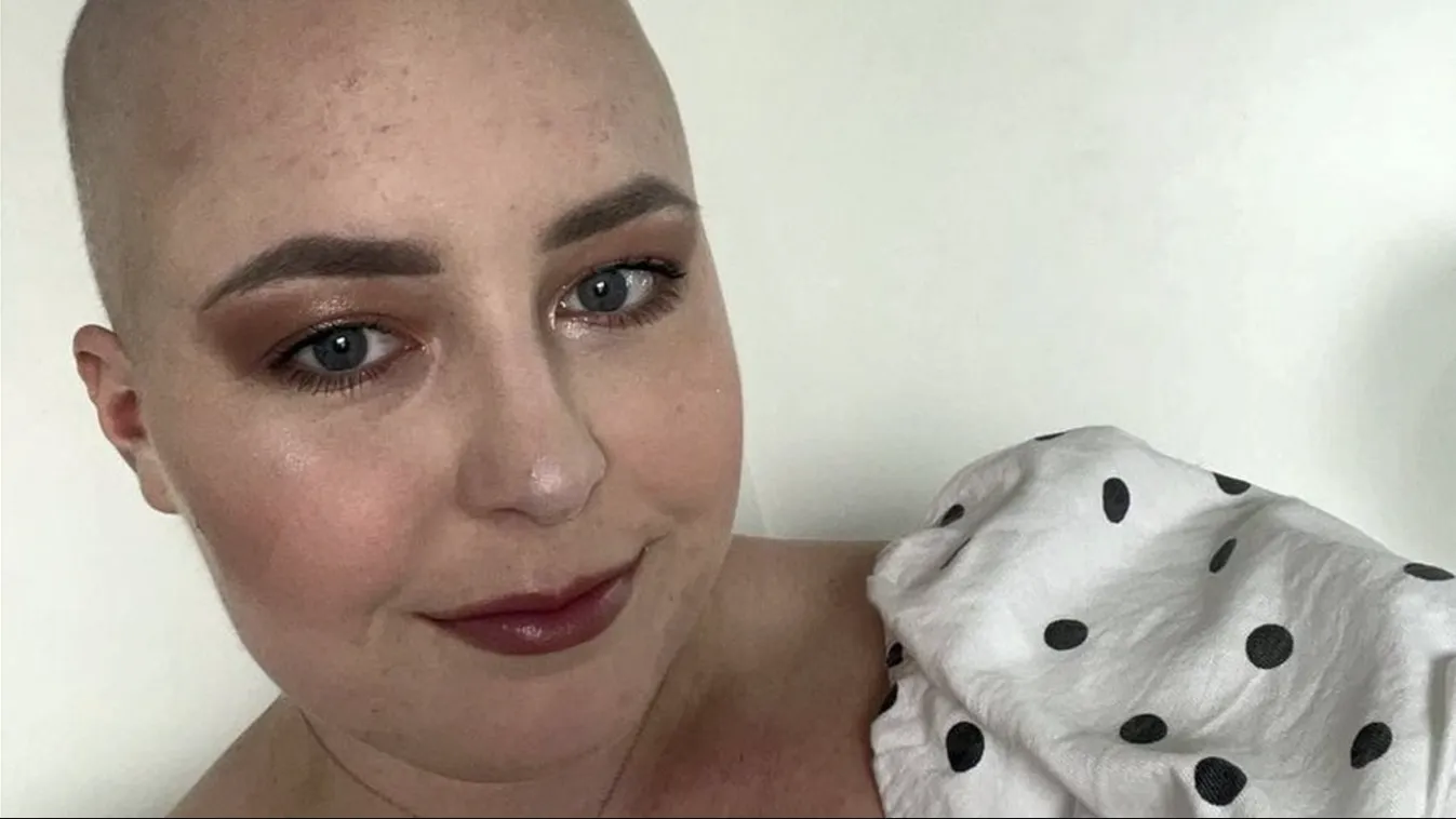 Tinédzserkori problémának hitték a kamasz lány rákos tünetét