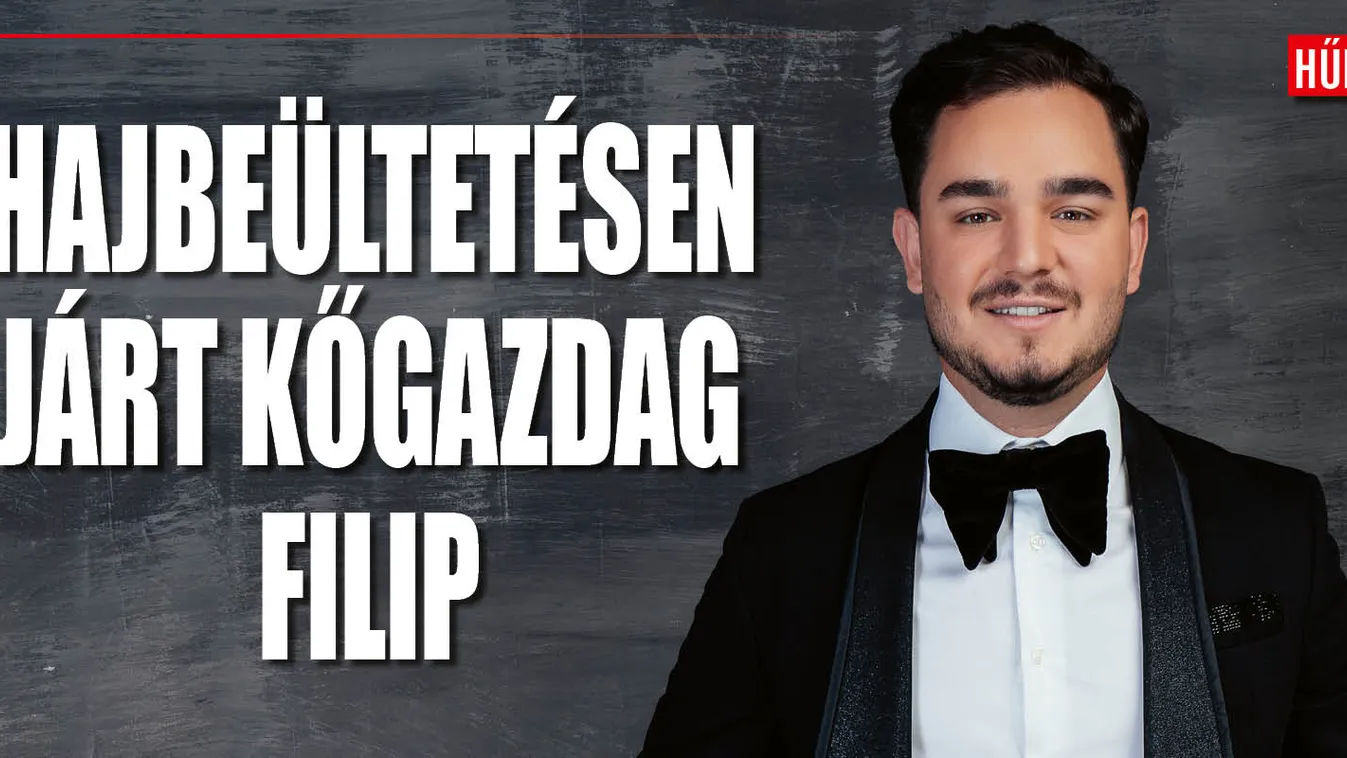 Hajbeültetésen járt a Kőgazdag Fiatalok sztárja!