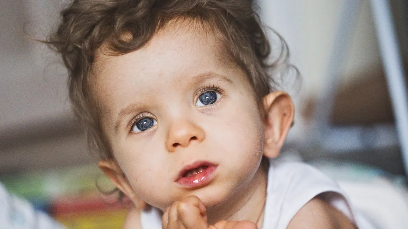 A világ egyik legritkább genetikai betegségével küzd Benő