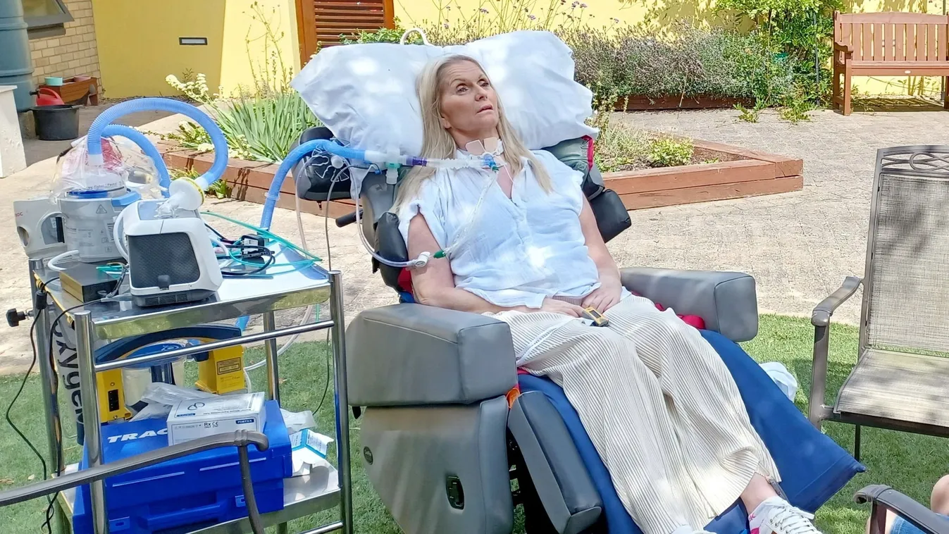 Csak a szemét képes mozgatni a balesete óta az édesanya