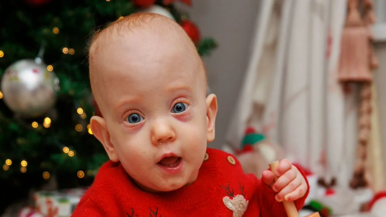 127 nap után térhetett haza a kórházból a csodababa