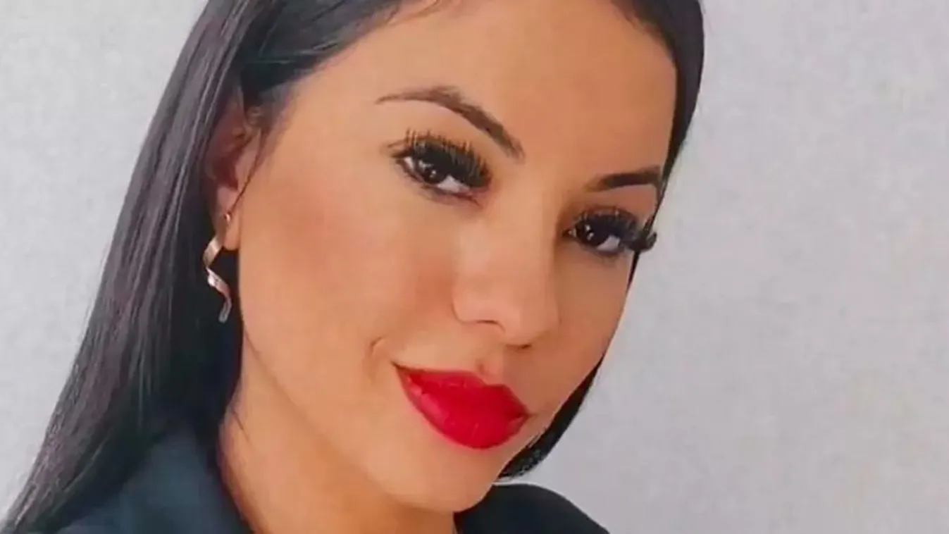 Csak szebb akart lenni: belehalt a zsírleszívásba Paloma