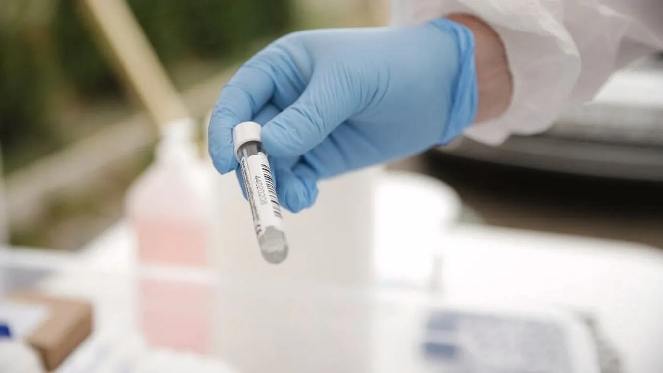 Aggasztó hírek: három halálos vírus is eltűnt egy laborból