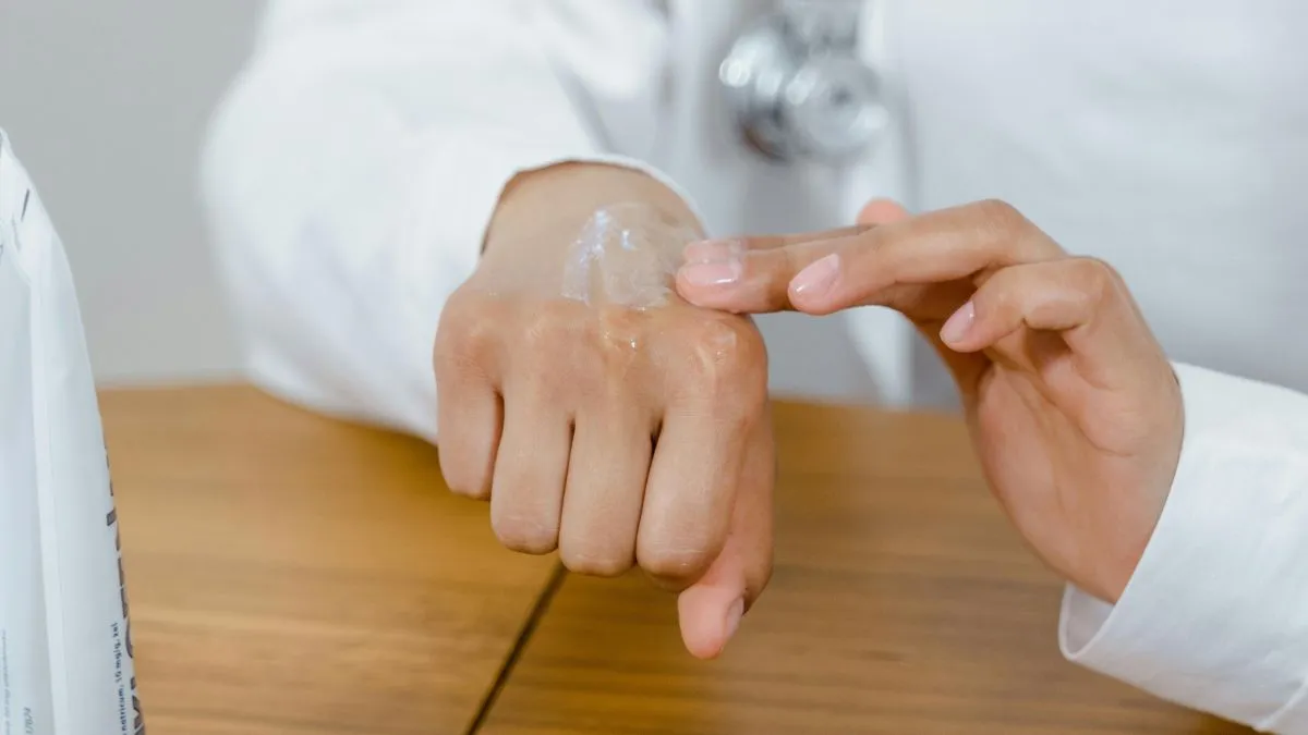 Óriási fájdalmakat élt át a bőrbetegségére felírt krém miatt