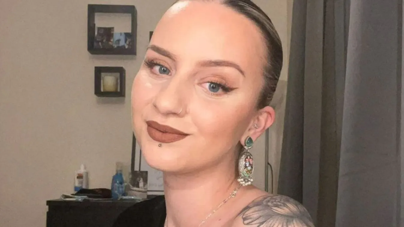 Ritka kórság miatt elhalad az élet a 26 éves nő mellett