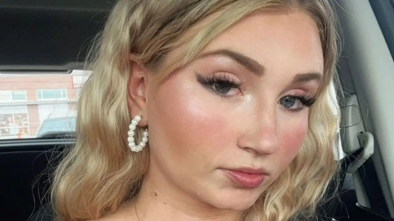 A 20 éves nő daganata az agya köré fonódott