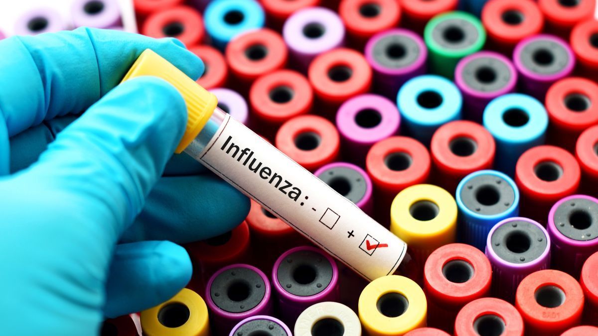 Minden, amit tudni lehet az influenzajárványról